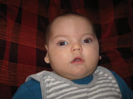 Bild zu