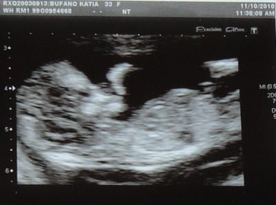 Bild zu Scan :-) - Forum für April - Mamis