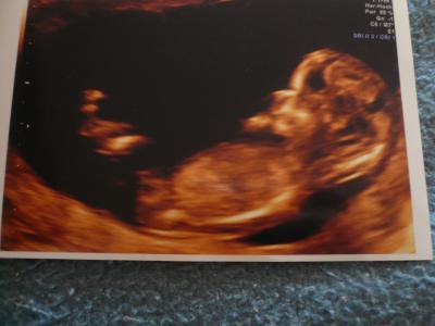 Bild zu Bild von NFM - Forum für April - Mamis
