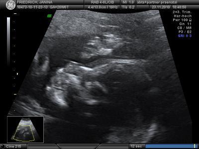 Bild zu Glücklich zurück von der FD!!! - Forum für April - Mamis