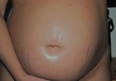 Bild zu Bauchi 24 SSW - Forum für April - Mamis