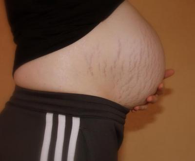 Bild zu Bauchbild! - Forum für April - Mamis
