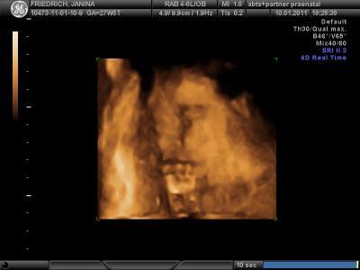 Bild zu 3D Bilder :) - Forum für April - Mamis
