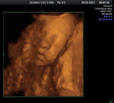 Bild zu Hier auch unser 3D Bild zu meinem Beitrag unten - Forum für April - Mamis
