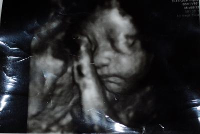 Bild zu Greta in 4d. - Forum für April - Mamis