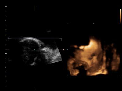 Bild zu hier unsere tochter inside:-) - Forum für April - Mamis