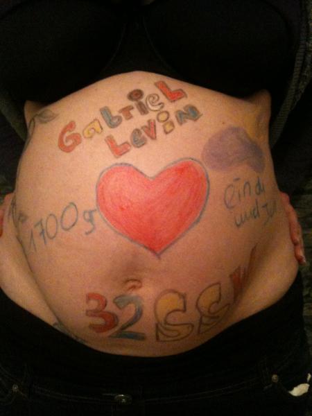 Bild zu 
