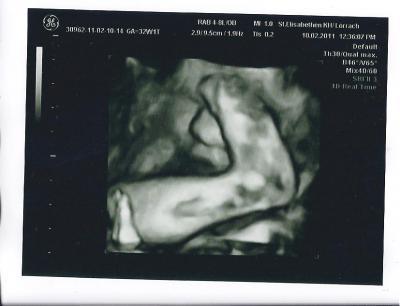 Bild zu Juhuuuuu endlich ein Bild - Forum für April - Mamis