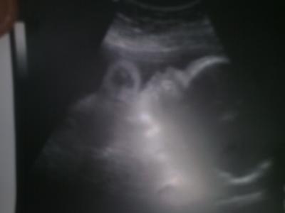 Bild zu will euch mal mein baby vorstellen - Forum für April - Mamis