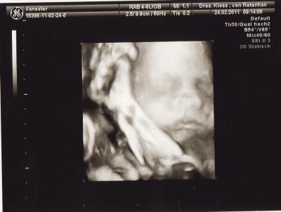Bild zu Soo 3D bilder abgeholt... - Forum für April - Mamis