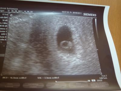 Bild zu Erster FA-Termin mit US-Bild - Forum für April - Mamis