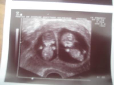 Bild zu Zurück von der Untersuchung :-) - Forum für April - Mamis