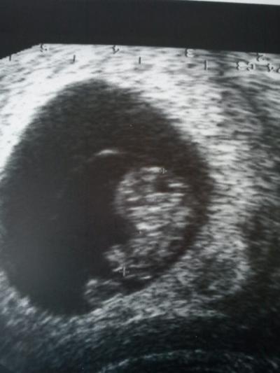 Bild zu So,jetzt noch mein US-Bildchen von heut :) - Forum für April - Mamis