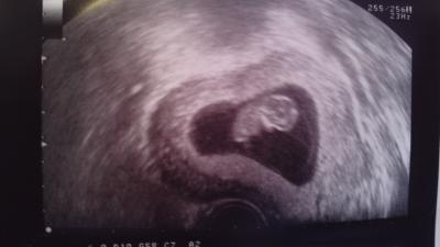 Bild zu Foto!!!! =D - Forum für April - Mamis