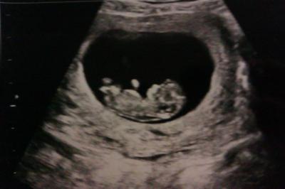 Bild zu us bild - Forum für April - Mamis