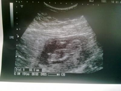 Bild zu Zurück vom FA... - Forum für April - Mamis