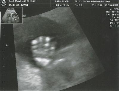 Bild zu Leider noch kein Outing... aber Baby winkt =) - Forum für April - Mamis