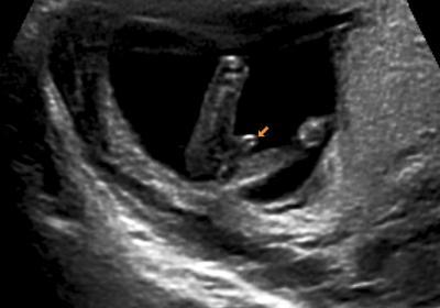 Bild zu huhu - Forum für April - Mamis