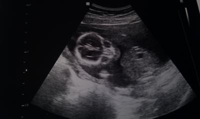 Bild zu wieder da vom Termin - Forum für April - Mamis