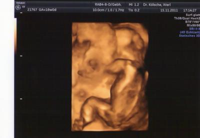 Bild zu °°°°°Gestern Fa Termin °°°°° - Forum für April - Mamis