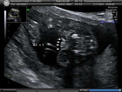 Bild zu Awww *freu* - Forum für April - Mamis