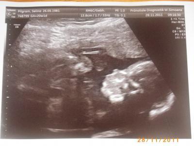 Bild zu Zurück von FD :) - Forum für April - Mamis