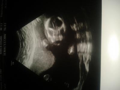 Bild zu es rappelt und Zappelt - Forum für April - Mamis