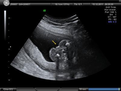 Bild zu zurück von der FD ! - Forum für April - Mamis