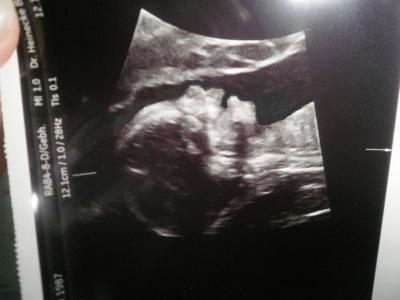 Bild zu wollte euch mal meine maus zeigen - Forum für April - Mamis