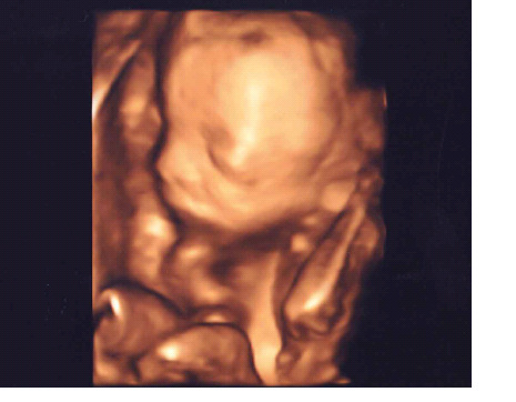 Bild zu Zurück vom FA und sooooo verliebt! - Forum für April - Mamis