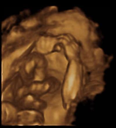 Bild zu FD - Forum für April - Mamis