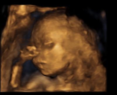 Bild zu Darf ich vorstellen mein Kleiner:-) - Forum für April - Mamis