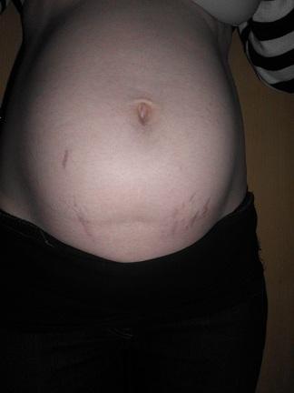 Bild zu Bauchbilder - Forum für April - Mamis