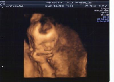 Bild zu Darf ich vorstellen :) - Forum für April - Mamis