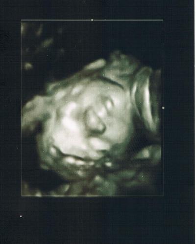 Bild zu CTG und VU - Forum für April - Mamis