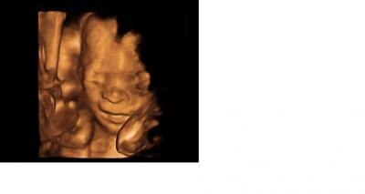 Bild zu Aktuelles Bild von meinem kleinen Prinzen - Forum für April - Mamis