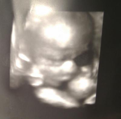 Bild zu 3d US Bild - Forum für April - Mamis