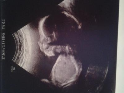 Bild zu Bild - Forum für April - Mamis