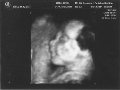 Bild zu kuckt mal.... - Forum für April - Mamis