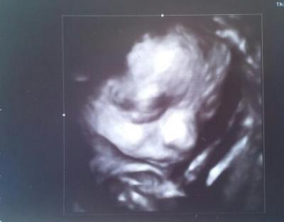 Bild zu Zurück vom FA und BILD :-) - Forum für April - Mamis