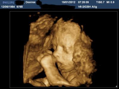 Bild zu Foto von meiner Maus - Forum für April - Mamis