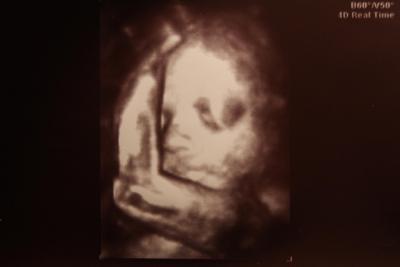 Bild zu 3. US + Bild - Forum für April - Mamis