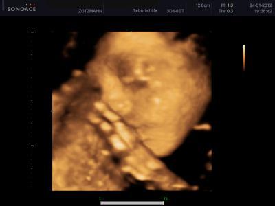 Bild zu Unser Engelchen - Forum für April - Mamis