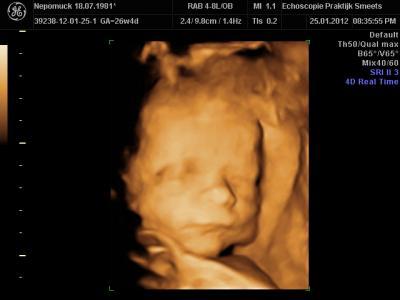 Bild zu Größe und Gewicht Baby - Forum für April - Mamis