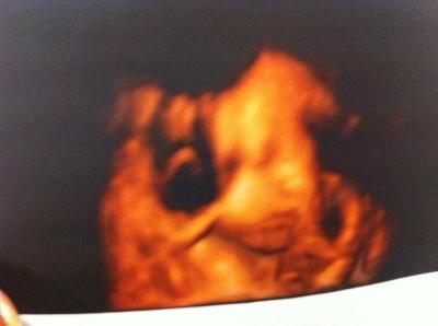 Bild zu Zurück vom Pränataldiagnostiker - Forum für April - Mamis