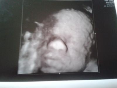 Bild zu doppler gehabt - Forum für April - Mamis