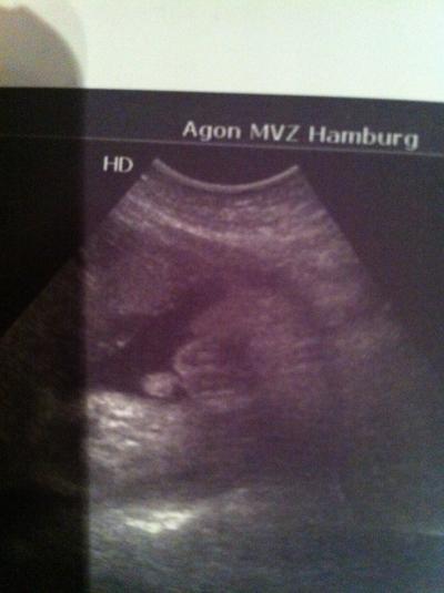 Bild zu Foto von meinem jungen :) - Forum für April - Mamis