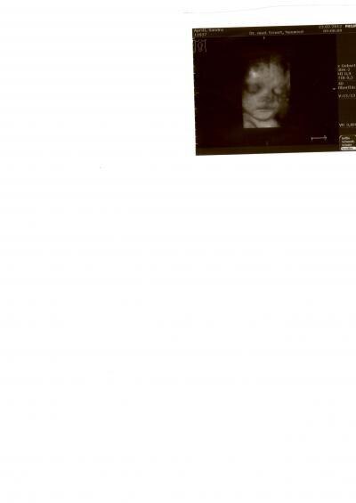 Bild zu Bauchzwerg - Forum für April - Mamis