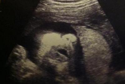 Bild zu letzter ultraschall :) - Forum für April - Mamis