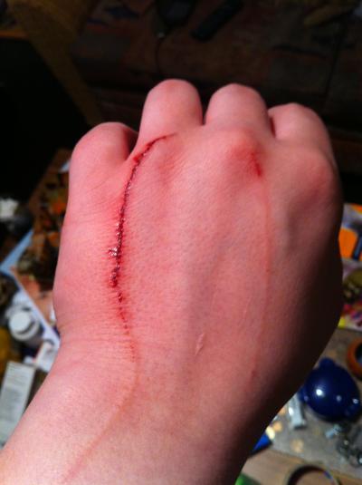 Bild zu Autsch....blöder Kater - Forum für April - Mamis